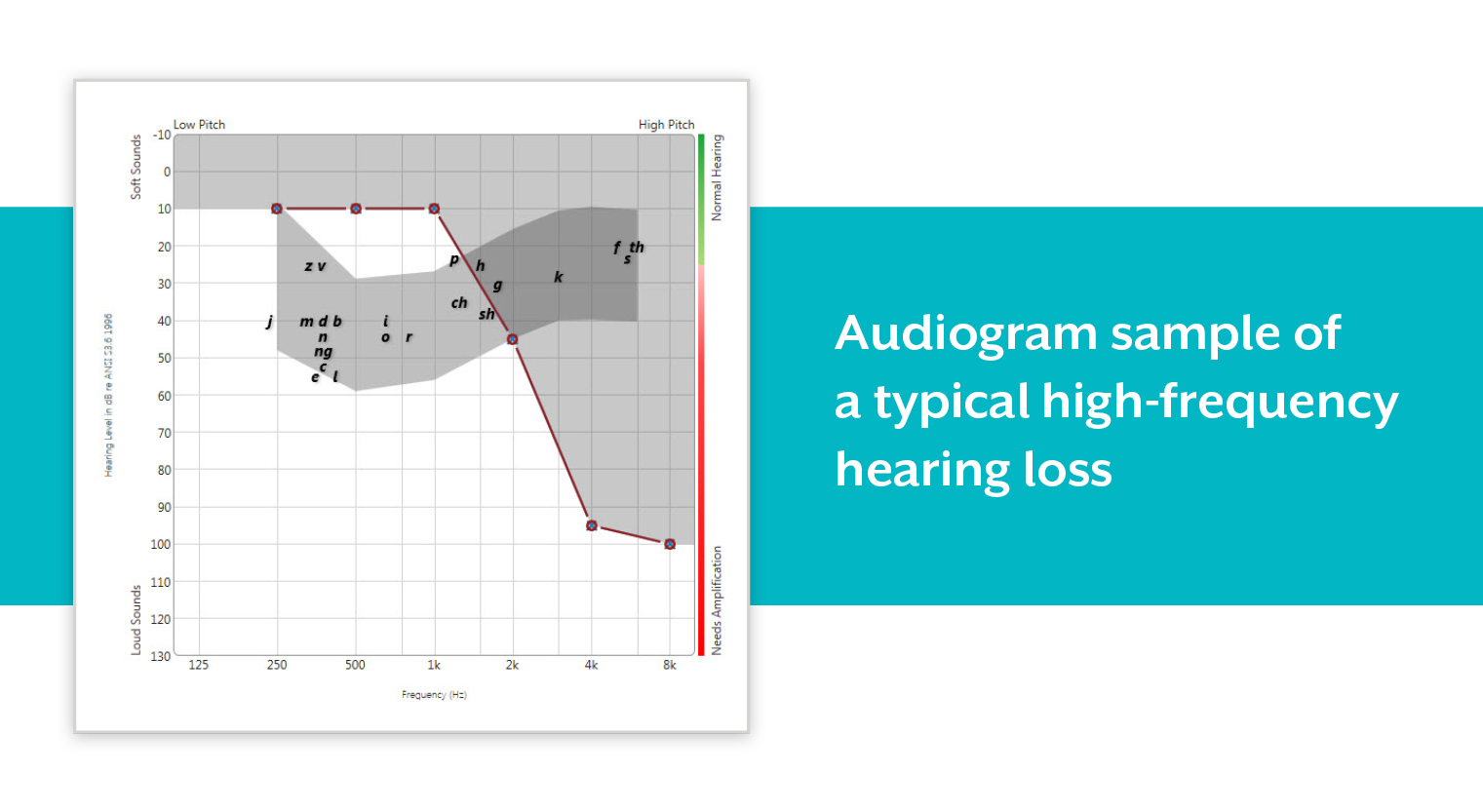 Mar_18_High_Frequency_Hearing_Loss